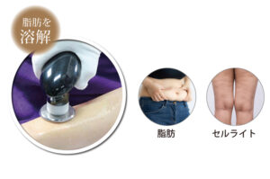 痩身-施術