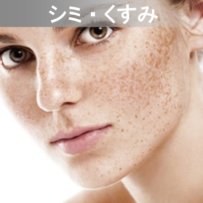 Eライト対応メニュー シミ・くすみ