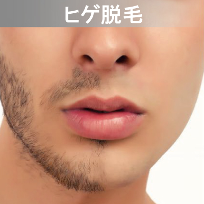 Eライト対応メニュー ヒゲ脱毛