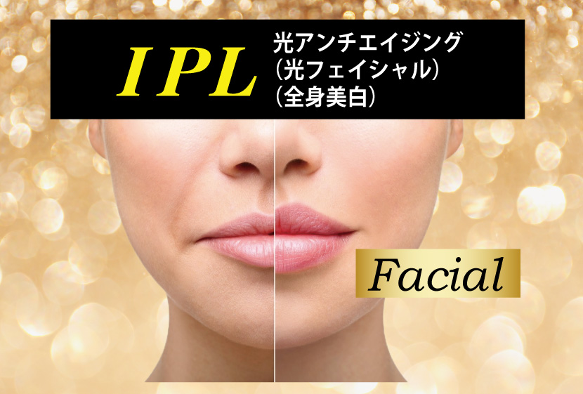 IPL