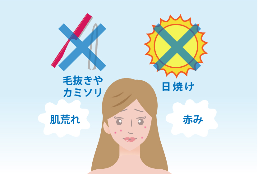 顔脱毛後の注意点
