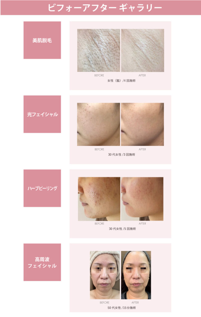 ビフォーアフター一覧