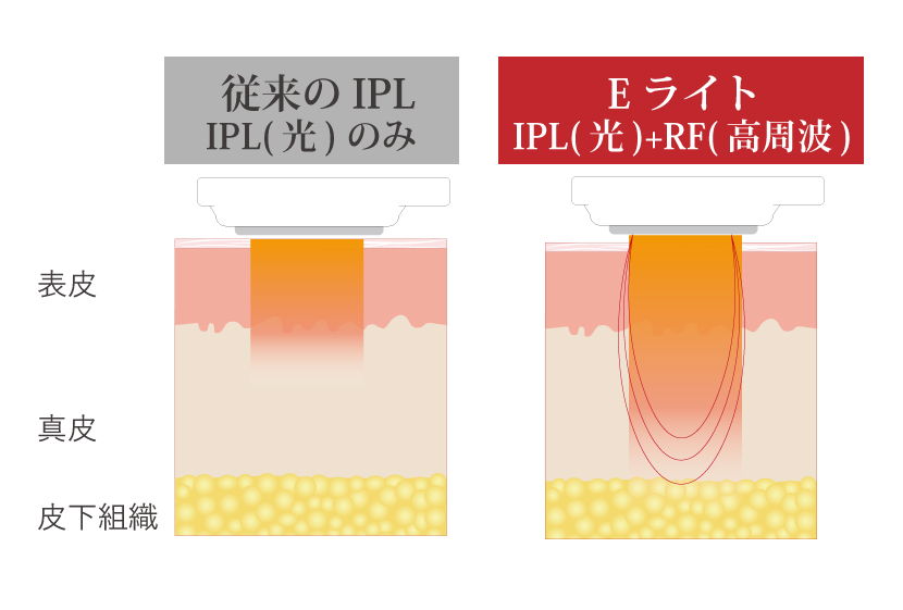 IPL仕組み