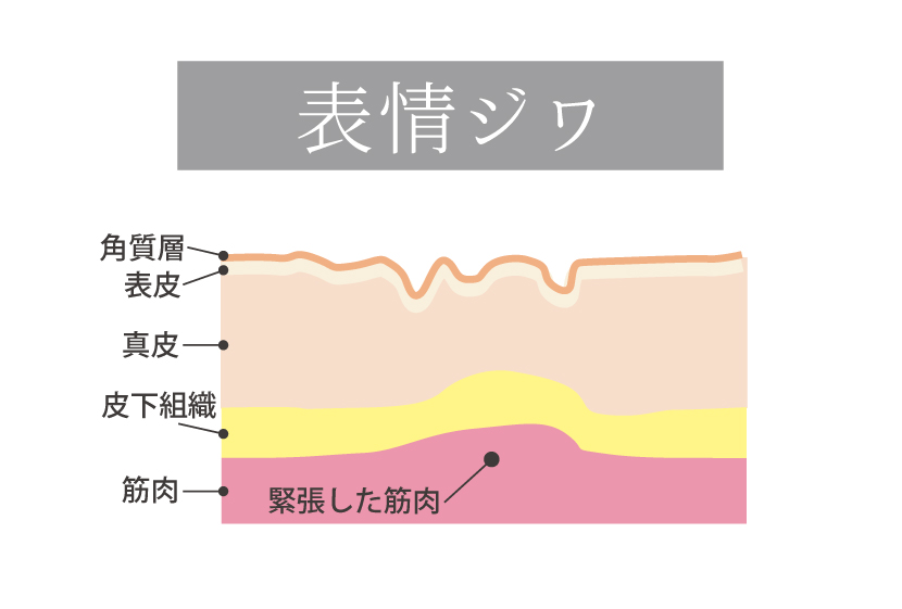 表情ジワ