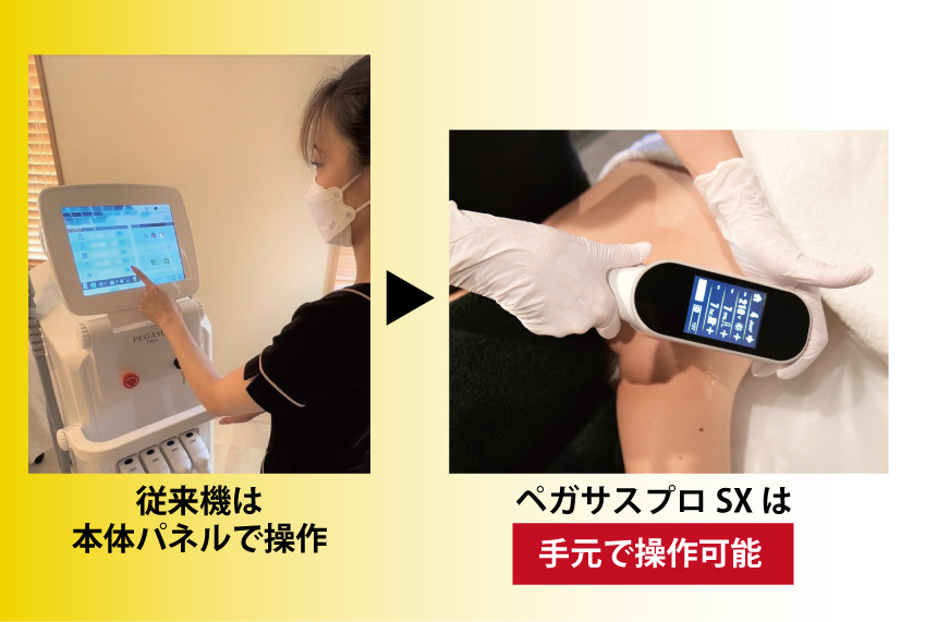 ②【インテリジェントハンドル】SX名称変更