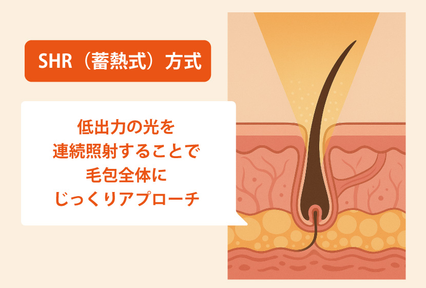 蓄熱方式
