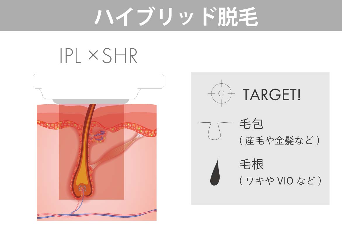 IPLSHR対応のハイブリッド脱毛