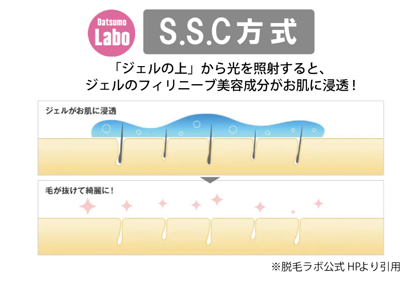 SSC方式とは