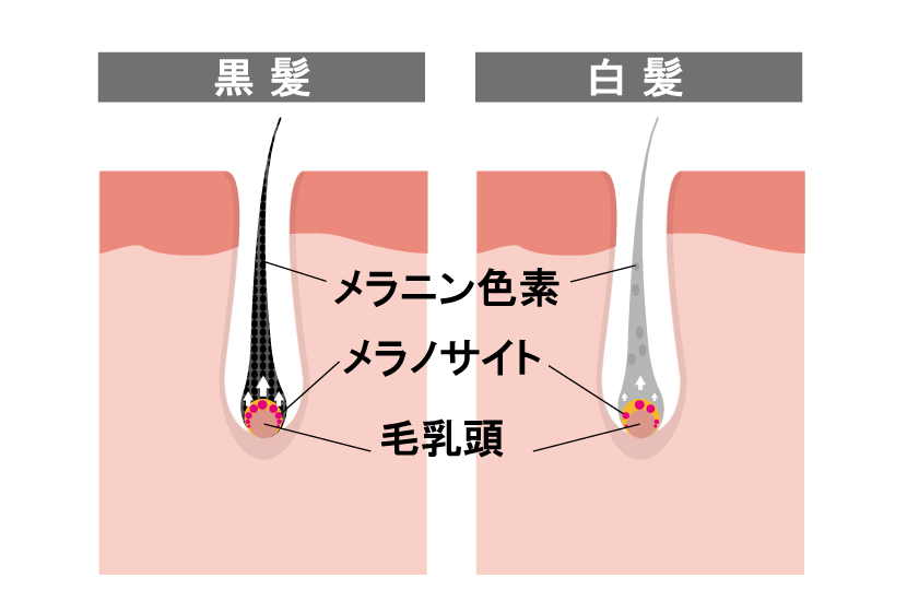 白髪の仕組み